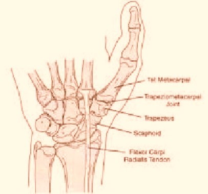 After Dr. Steinberg Treated Tendonitis in Her Thumbs, Brenda Has No Pain Whatsoever